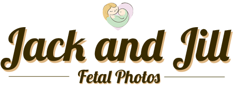 3D and 4D Baby Ultrasound | Jack and Jill Fetal Photos | Phoenix Prenatal Imaging